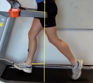 Overstride as shown on a treadmill