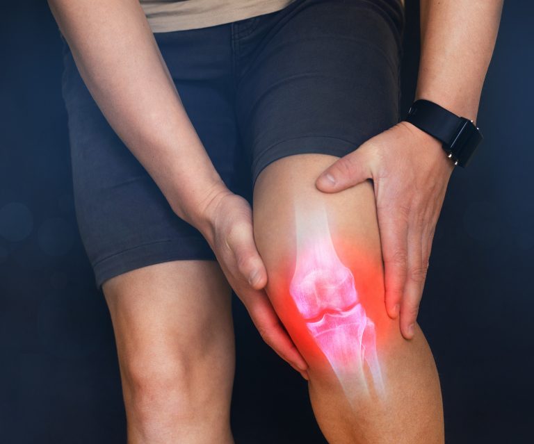 Why Does My Knee Hurt? AKA Runner’s Knee